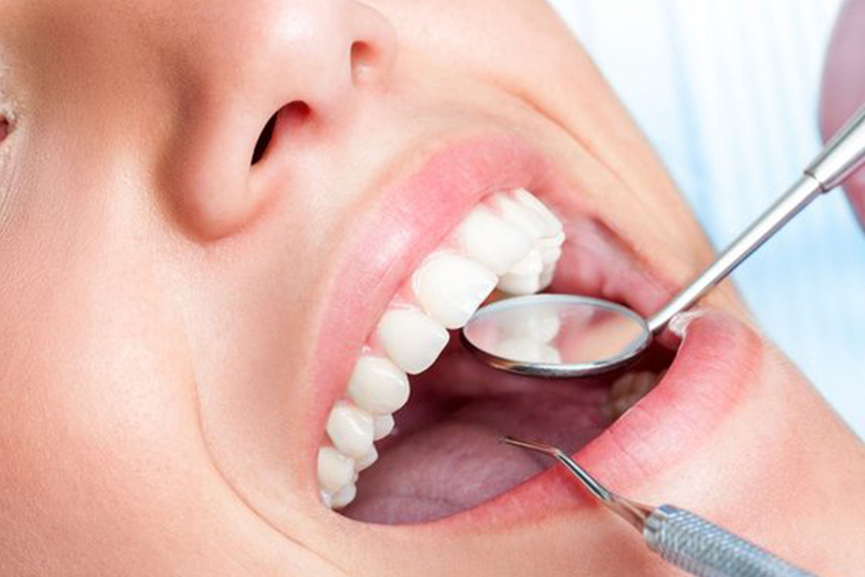 parodontologie-compressor